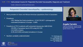 2 Clinical presentation epidemiology differences between ethnic groups genetic factors others [upl. by Ralat]