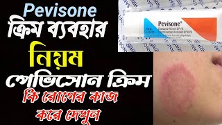 Pevisone Cream ointment Review [upl. by Ahsikar]