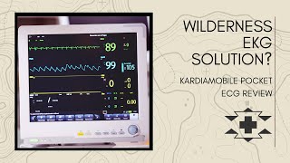 Wilderness EKG KardiaMobile Pocket ECG review [upl. by Lutero]