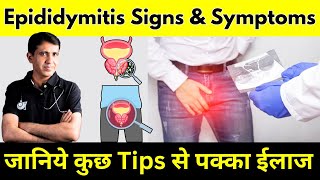 Epididymitis Symptoms  अंडकोष की समस्या का पक्का ईलाज  By Dr Ramdeo Lamoria [upl. by Marcelia]