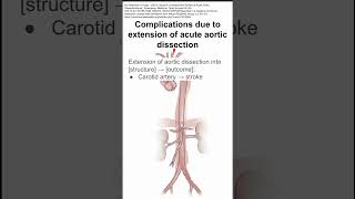 Complications due to extension of acute aortic dissection [upl. by Anialam]