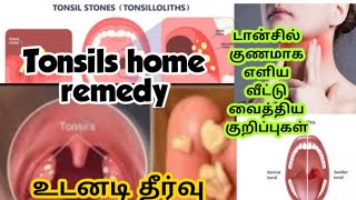 Tonsils home remedyTonsilshomeremedyடான்சில் தொண்டைவலி உடனடி தீர்வுTonsil home remedy in Tamil [upl. by Ariad]