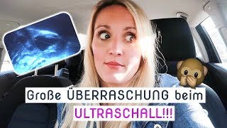 Vlog  Aufgeregt  Termin beim Frauenarzt  1 Zyklus nach Absetzen der Pille  Annis Blog [upl. by Toinette]