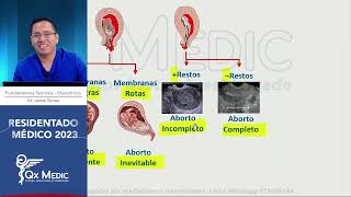 Obstetricia  9 Hemorragia obstétrica I mitad [upl. by Attesoj]