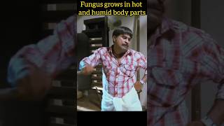 FUNGAL INFECTION😵‍💫🥴 fungi reelsinstagram skin trendingreels skin reelsvideo trending [upl. by Ettari]