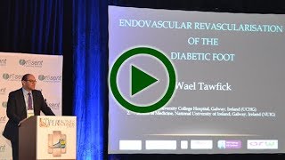 PRESENT Podiatry  Endovascular Revascularization of the Diabetic Foot [upl. by Treblig98]