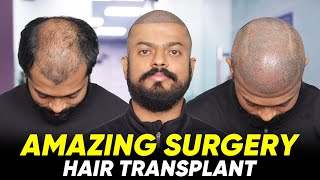 Hair Transplant in Guwahati  Best Results amp Cost of Hair Transplant in Guwahati [upl. by Lianne]