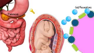 What is Gestational Diabetes animation [upl. by Thad]