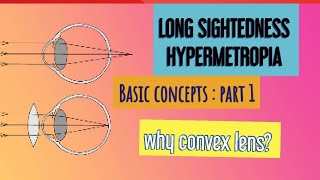 HYPERMETROPIA  BASICS to ADVANCED [upl. by Nylyoj]