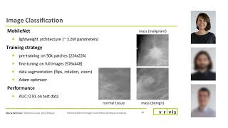 Explainable AI XAI Interpreting Mammography Image Classifiers [upl. by Osner]