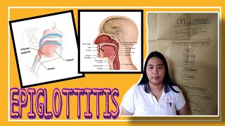 EPIGLOTTITIS  PATHOPHYSIOLOGY [upl. by Ateekahs728]