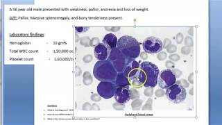 Pathology 357 b CML Chronic Myeloid Leukemia Case Study Philadelphia leukemoid reaction [upl. by Eneg]