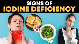 5 Hidden Symptoms of Iodine Deficiency  Iodine क्यों important है Dr hc Palak Midha [upl. by Ymrej]