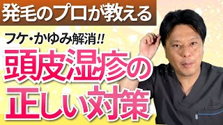 【頭のかゆい人向け】放っておくとキケン頭皮湿疹の種類とフケ・かゆみ・赤みの原因と対策～自宅でも出来るケア～ [upl. by Sophey]