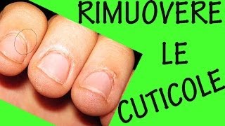 COME RIMUOVERE LE CUTICOLE Sos unghie 9 [upl. by Ahsemed]