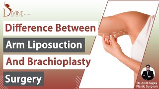 Difference between Arm Liposuction and Brachioplasty Surgery  Divine Cosmetic Surgery [upl. by Ylus362]