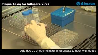 Plaque Assay for Influenza Virus [upl. by Zimmermann]