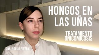 Hongos en las uñas onicomicosis Tratamientos [upl. by Riaj634]