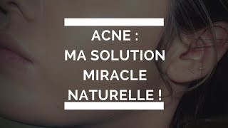 2018 Remède MIRACLE Naturel CONTRE Acné et Microkystes [upl. by Ennairrek]