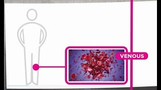 Venous Thrombosis Explained [upl. by Ivatts806]