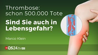 Thrombose – Prophylaxe und Behandlung  Kleinsche Felder  Marco Klein  QS24 Gesundheitsfernsehen [upl. by Schindler301]