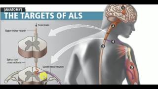 MEDICINE LECTURES  Neurology  AMYOTROPHIC LATERAL SCLEROSIS [upl. by Essirehc539]