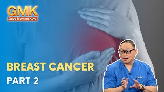 Mga sanhi ng Breast Cancer  Usapang Pangkalusugan [upl. by Gefen]