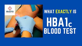 What is the HBA1c Blood Test for Diabetes [upl. by Mizuki]