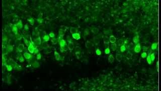 Monitoring neuronal activity in brain slices from a 2 year old Thy1GCaMP3 transgenic mouse [upl. by Ailet362]