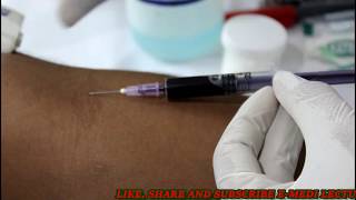 बल्ड कलेक्शन का आसान तरीका Blood collection technique Blood sample collection procedure [upl. by Nellad]