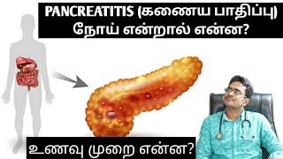 Pancreatitis causesamptreatment explanation in tamilmedical awareness in tamil [upl. by Leiuqeze]