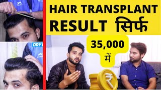 Life After Full Hair Transplant Result Of Saurabh Kukreti  Best Hairline Ever Created In History [upl. by Laehcimaj787]