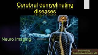 9cerebral demylinating diseases [upl. by Potts909]