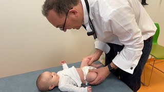 Examining for a Dislocated Hip in Infants [upl. by Asennav]