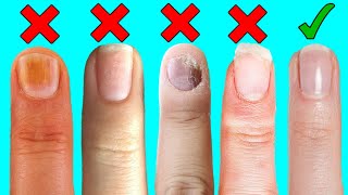 8 Things Your Nails Can Say About Your Health [upl. by Ivon]