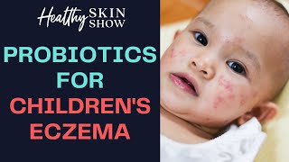 Using PROBIOTICS For Eczema in Children  Jennifer Brand [upl. by Craven]