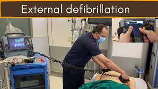 External defibrillation DC Shock [upl. by Waneta533]