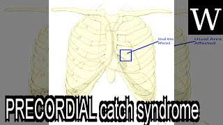 PRECORDIAL catch syndrome  WikiVidi Documentary [upl. by Atnes589]