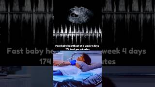 7 Weeks 4 Days Fast Baby Heartbeat 💓 Early pregnancy heartbeat boy or girl [upl. by Mairim491]