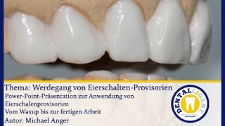 ZahntechnikGRATISWerdegang von EierschalenProvisorien [upl. by Hennahane]