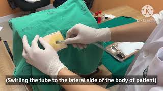 Chest tube insertion [upl. by Dorey]