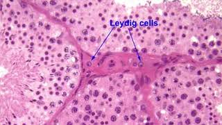 MAXIMIZE YOUR TESTOSTERONE  Leydig Cells [upl. by Worlock734]