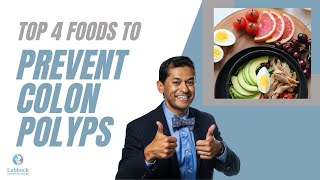 Foods that prevent polyps colon edition [upl. by Malcolm260]