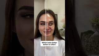 Watch how this filter transforms your appearance [upl. by Rendrag]