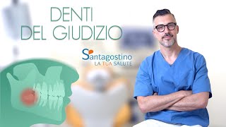 Denti del giudizio  diagnosi estrazione e postoperatorio [upl. by Nywrad532]