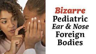 Bizarre Pediatric Ear and Nose Foreign Bodies [upl. by Courtland544]