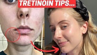 How to Use Tretinoin The Truth About Tretinoin [upl. by Eilzel838]