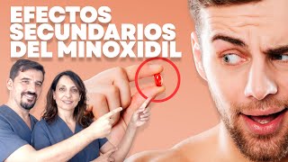 🔵 Minoxidil en pastillas y Minoxidil tópico 😵 Efectos secundarios [upl. by Leahcar]