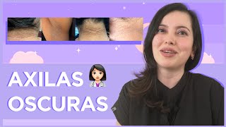 🥲¿Axilas oscuras Tips para cuidarlas [upl. by Otha560]