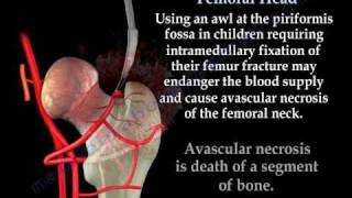 Avascular Necrosis Blood Supply Femoral Head Everything You Need To Know  Dr Nabil Ebraheim [upl. by Lambertson]